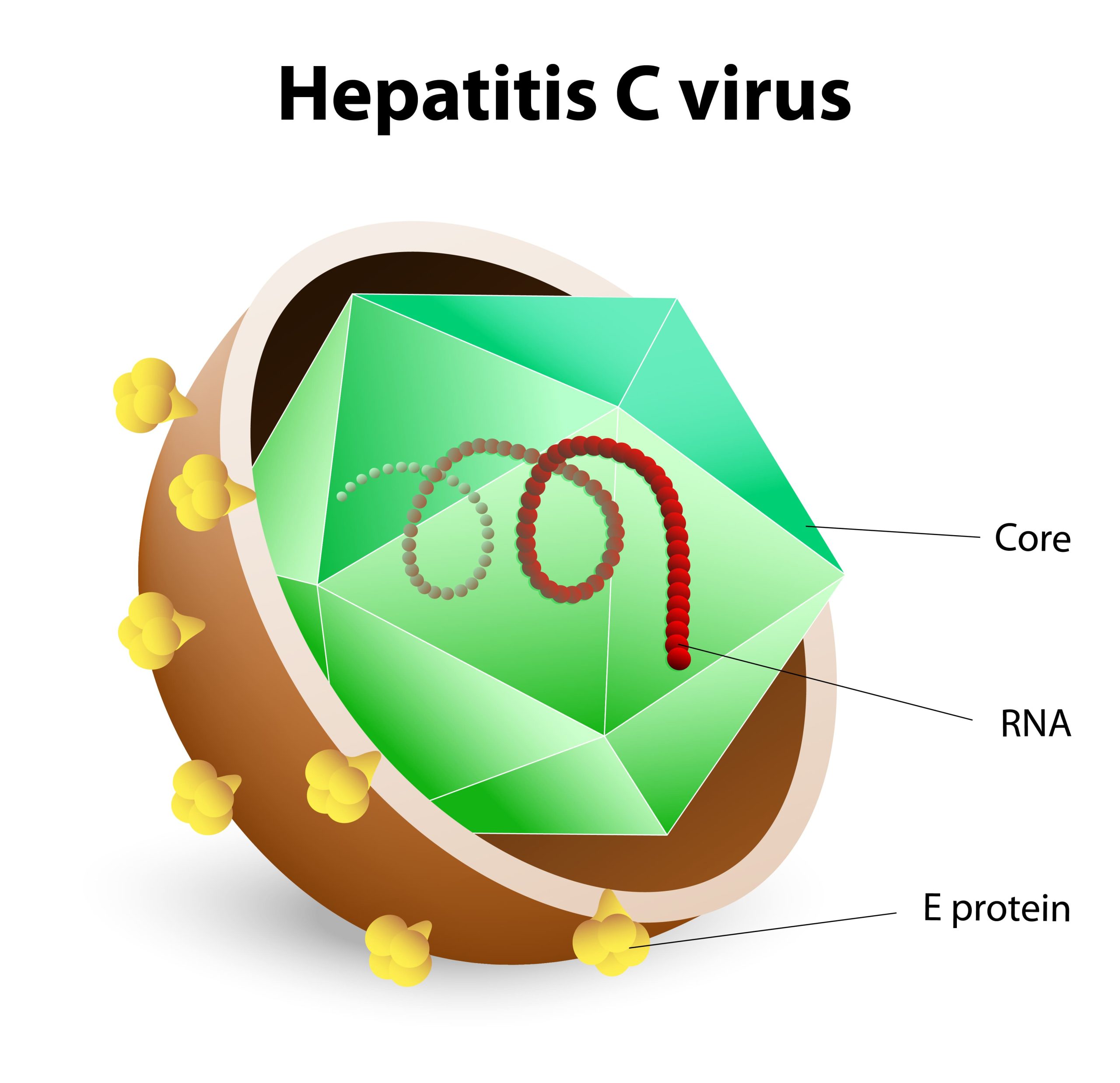 Hepatitis C