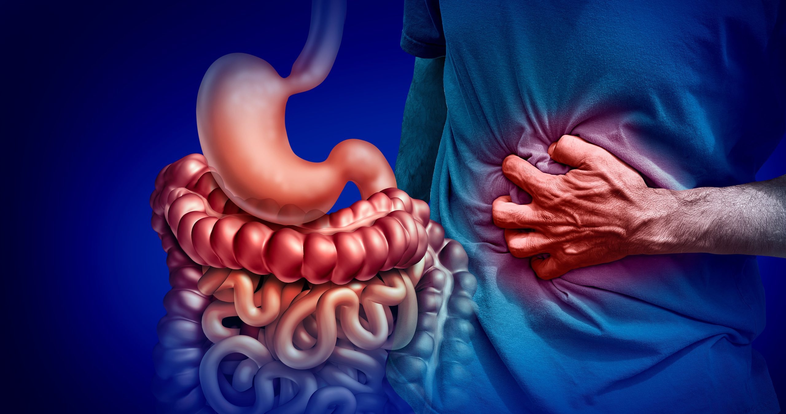 Crohn’s Disease